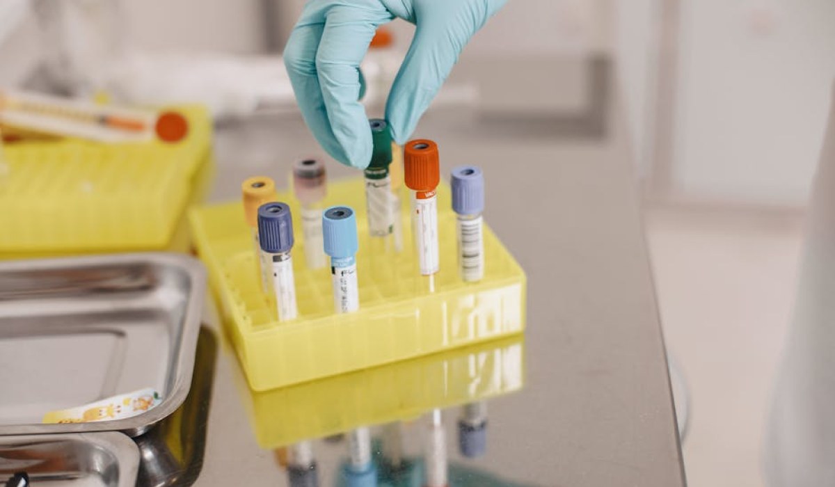 Brytyjski regulator bada kliniki peptydowe za nielegalne roszczenia zdrowotne